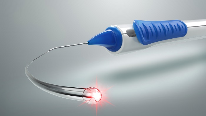 Nova Eye’s iTrack Advance Canaloplasty Device Approved in China