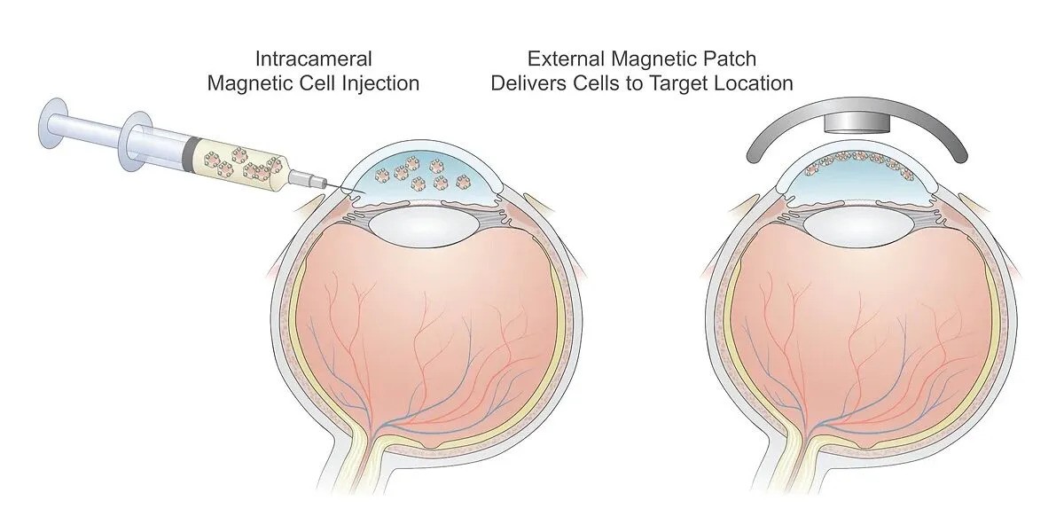 US FDA Grants RMAT Status to Emmecell’s Corneal Cell Therapy Candidate