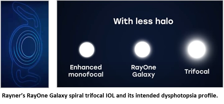 2024 ESCRS Congress Puts Spotlight on Latest IOL Designs