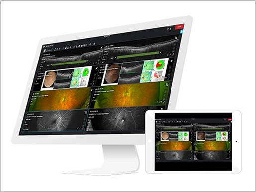 Topcon Acquires Retinal Screening  Platform to Improve Bidirectional Referrals