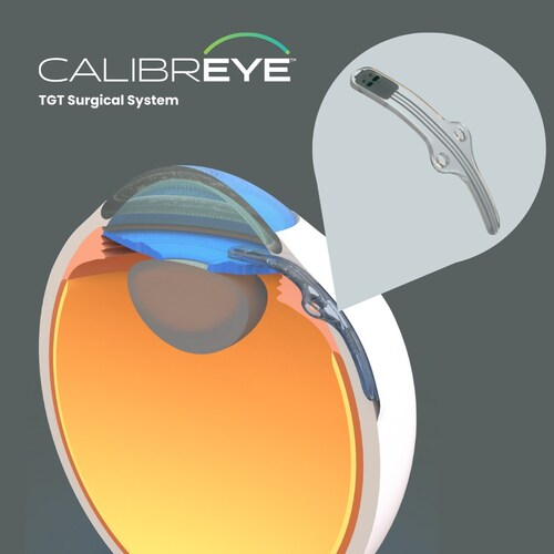 Myra Vision Gains IDE Approval to Begin US Trial of Adjustable Glaucoma Shunt