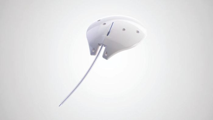 New World Medical Launches ClearPath ST with Smaller Tube Lumen