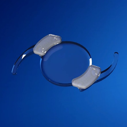 SpyGlass Gains Category III CPT Code for Its Drug-Eluting BIM-IOL System